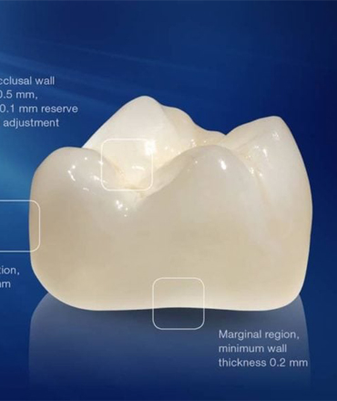 Sứ Cercon